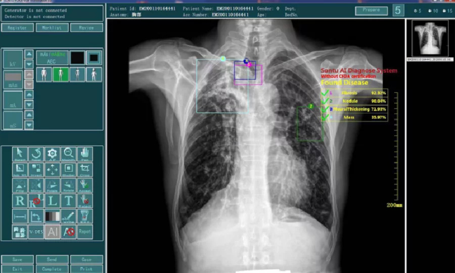 AI Diagnostic System