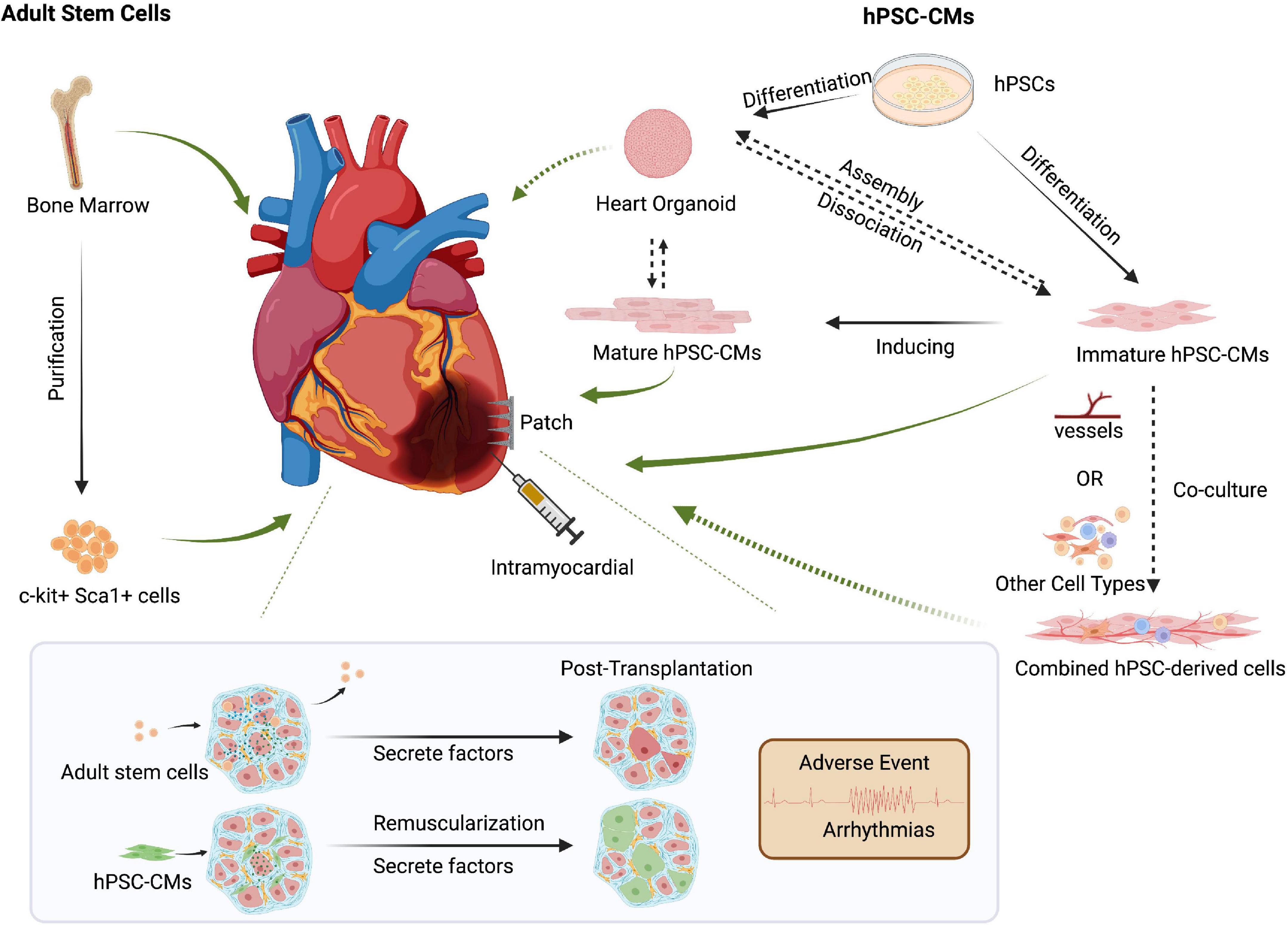 Cardiac Regeneration