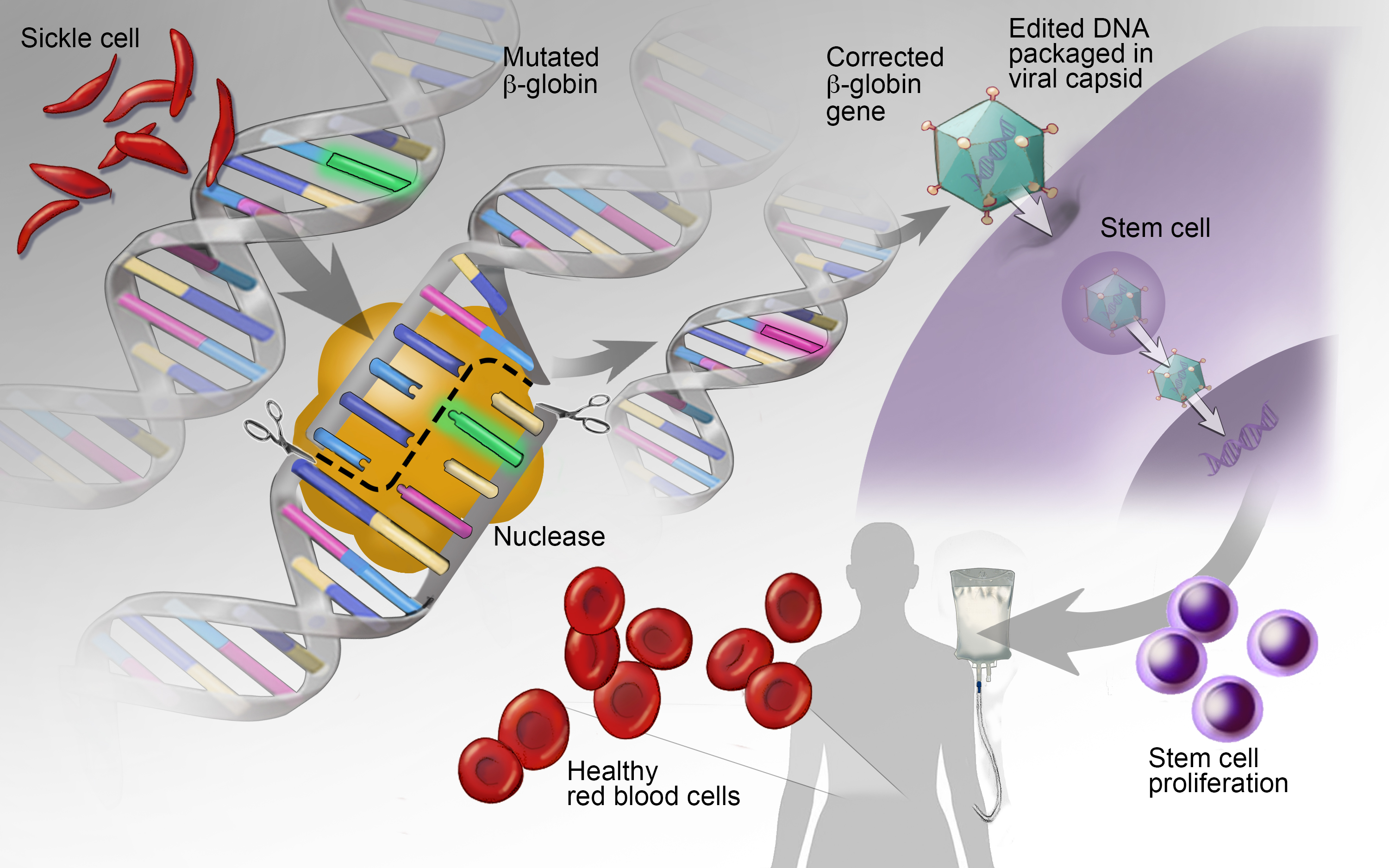 Gene Therapy
